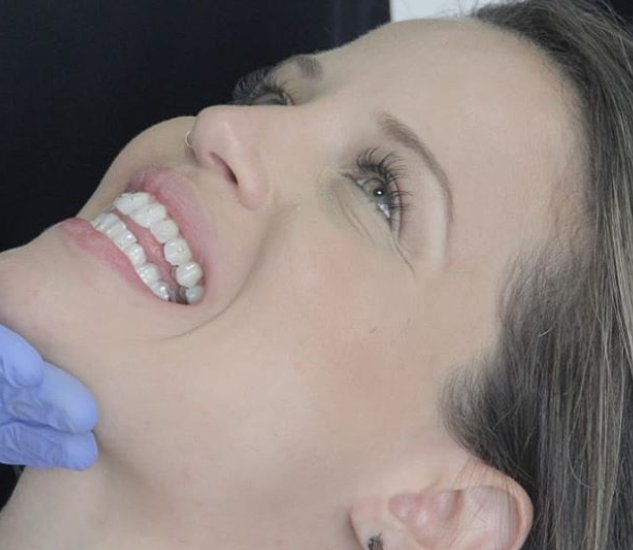 Aparelho fixo autoligado: entenda os custos do tratamento | NewONE Orthodontics