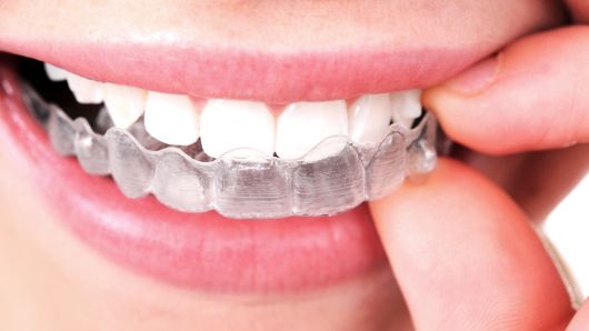 O que é ortodontia | NewONE Orthodontics