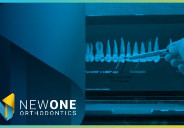 LIVE - Como utilizar a Ancoragem Esquelética no Tratamento Híbrido? | NewONE Orthodontics